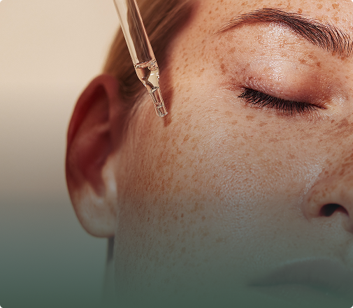 How-to-Get-Rid-of-Melasma