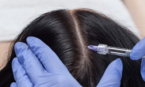 hair-related-problems-pqs9wcbme5idq4ceu98fcvpfxx5f5mizlwx9srj9a0
