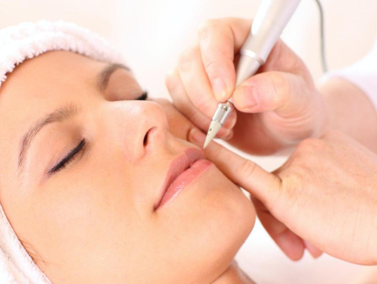 hair-removal-electrolysis01600